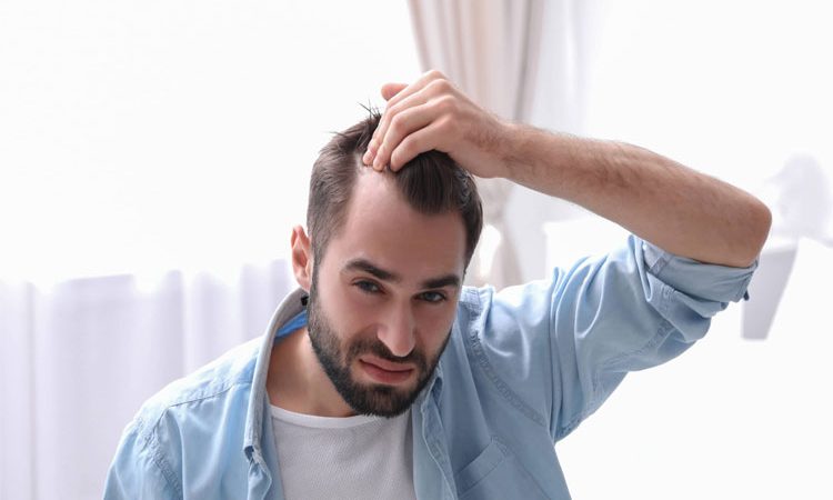 هرآنچه که باید قبل از انجام کاشت مو بدانید! عوارض، ویژگی ها و مراقبت های مهم کاشتن مو