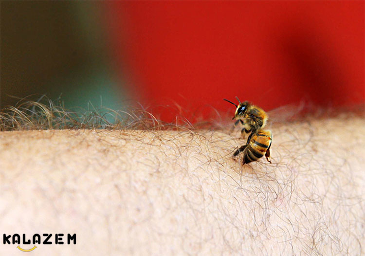 درمان های طبیعی برای نیش خوردن توسط زنبور