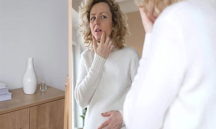 آیا آکنه بارداری قابل درمان است؟ روش های آسان و سریع رفع جوش در دوران حاملگی