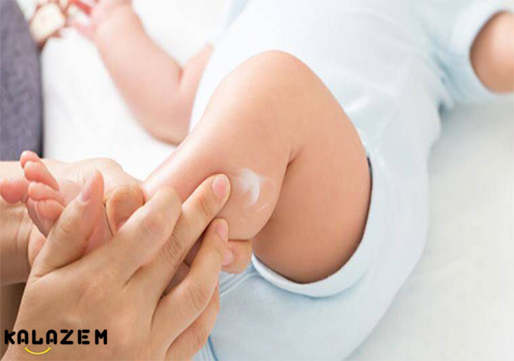 درمان خشکی پوست نوزاد