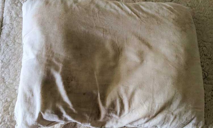 زرد شدن بالش