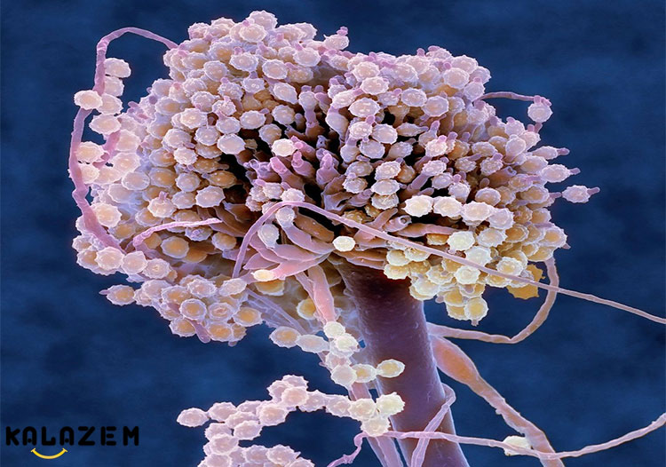 5 نکات پیشگیری از عفونت قارچی پوست