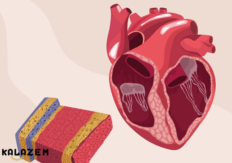انواع اکستراسیستول انواع اکستراسیستول