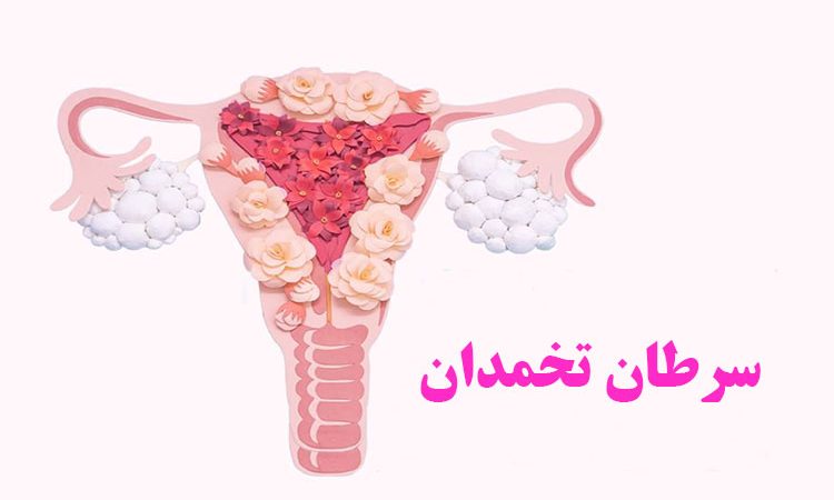 سرطان تخمدان