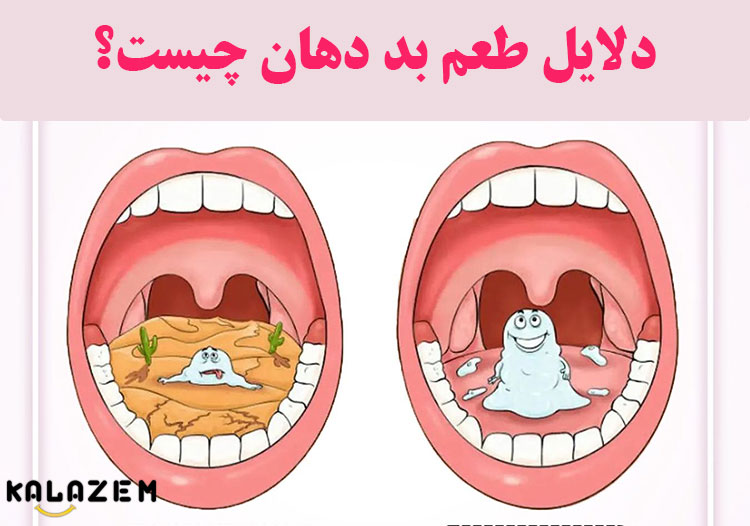 طعم بد دهان