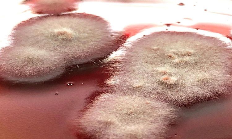 عفونت قارچی پوست