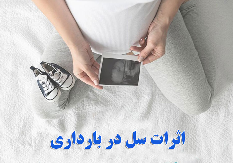 اثرات سل در بارداری