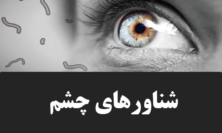شناورهای چشم