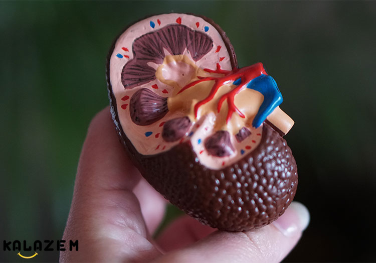 علل کیست کلیه علل کیست کلیه