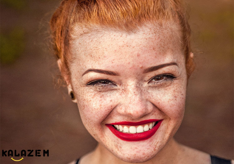 ملانین در پوست و چشم فواید دارد ملانین در پوست و چشم فواید دارد