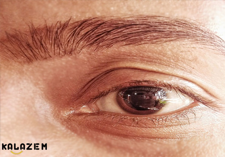 چه چیزی باعث شناور شدن چشم می شود؟ چه چیزی باعث شناور شدن چشم می شود؟
