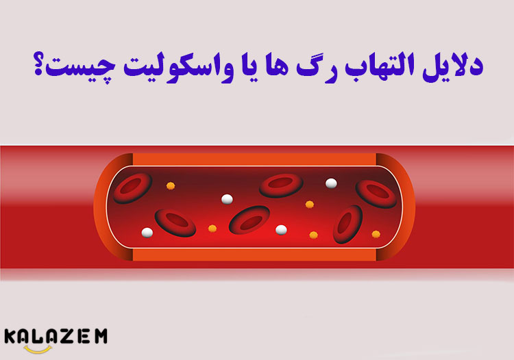 دلایل التهاب رگ ها یا واسکولیت چیست؟ دلایل التهاب رگ ها یا واسکولیت چیست؟