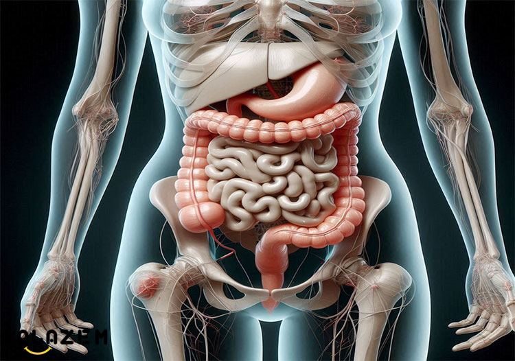 سندرم روده نشتی چیست؟