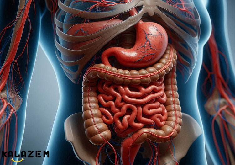 پارگی آپاندیس