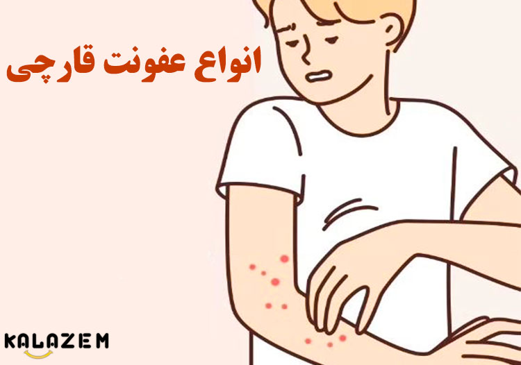 آیا کاندیدا یک بیماری دارویی جایگزین نیست؟