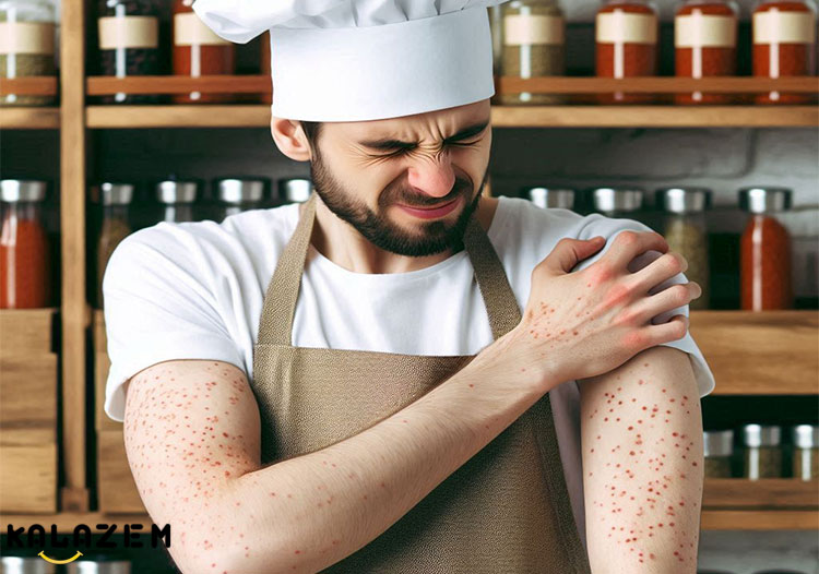 علائم آلرژی به ادویه ها