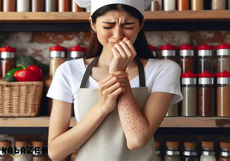 علائم آنافیلاکسی