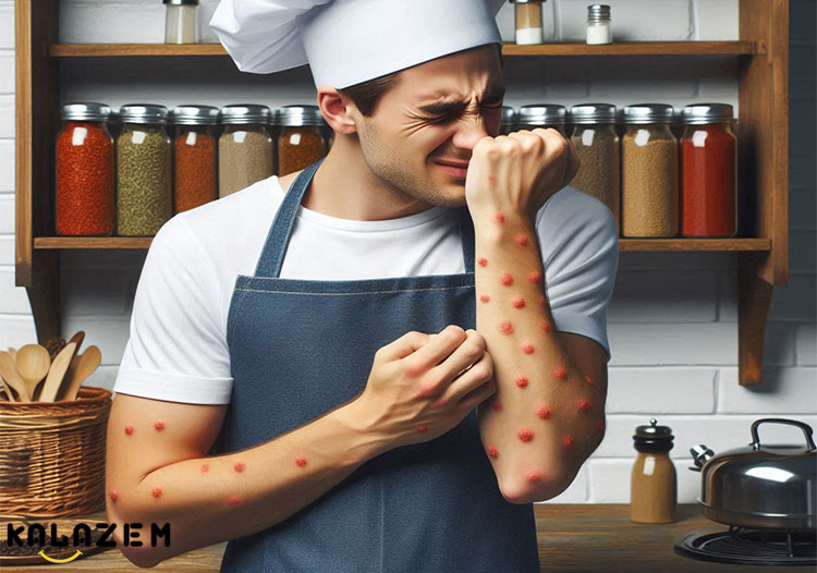 پیشگیری از آلرژی به ادویه