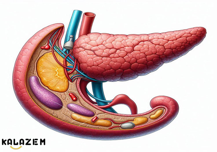 تشخیص سرطان لوزالمعده