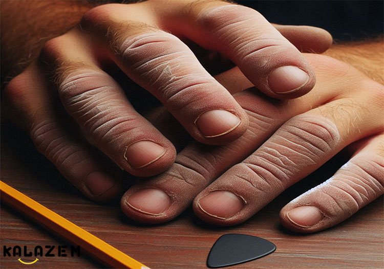 چگونه از شر پینه انگشت و روی دست خلاص شویم؟